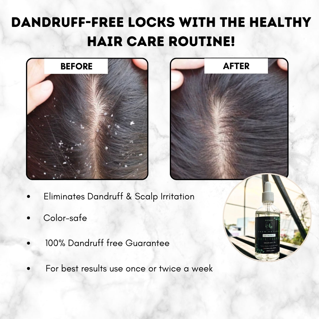 Anti Dandruff Hair toner