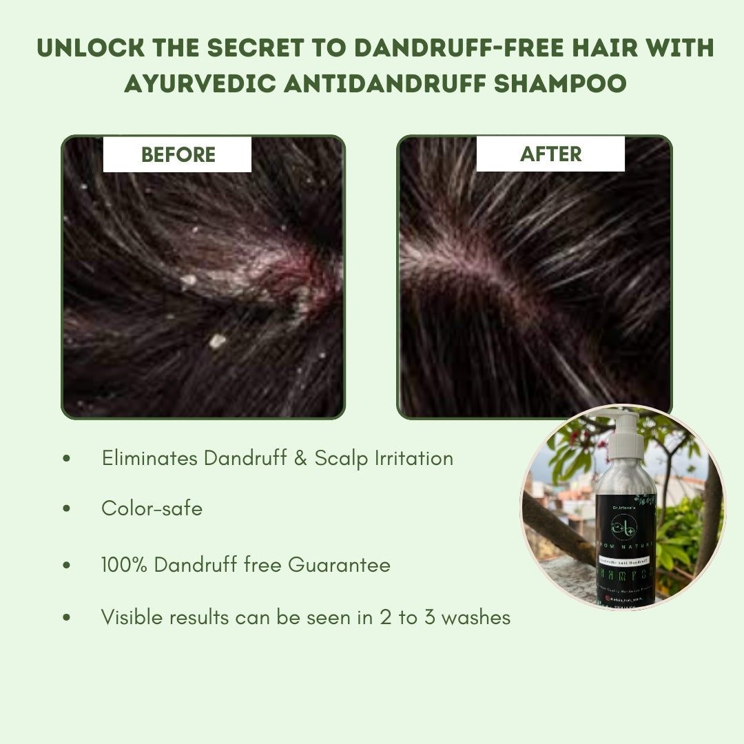 ANTI-Dandruff Shampoo